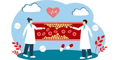 High Cholesterol and Cardiovascular Disease